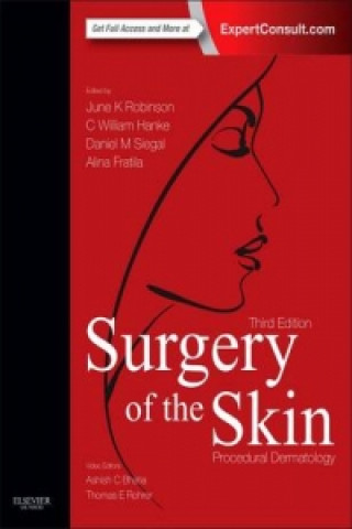 Knjiga Surgery of the Skin June K. Robinson