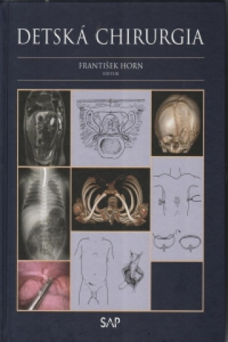 Book Detská chirurgia František Horn