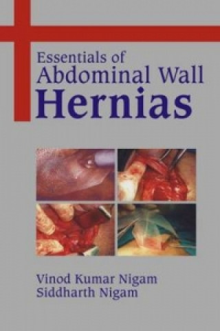 Carte Essentials of Abdominal Wall Hernias S. Nigam