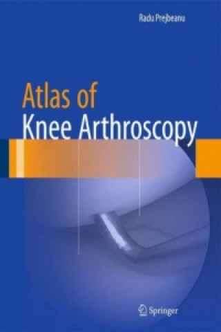 Kniha Atlas of Knee Arthroscopy Radu Prejbeanu
