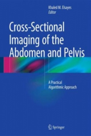 Kniha Cross-Sectional Imaging of the Abdomen and Pelvis Khaled M. Elsayes