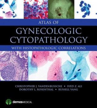 Könyv Atlas of Gynecologic Cytopathology Christopher Vandenbussche