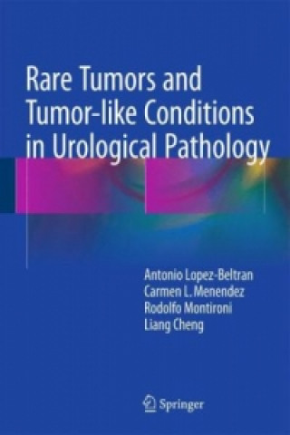 Libro Rare Tumors and Tumor-like Conditions in Urological Pathology Antonio Lopez-Beltran