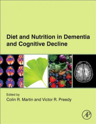Carte Diet and Nutrition in Dementia and Cognitive Decline Colin R. Martin