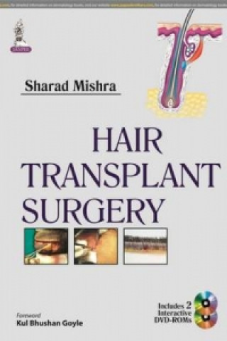 Book Hair Transplant Surgery Sharad Mishra