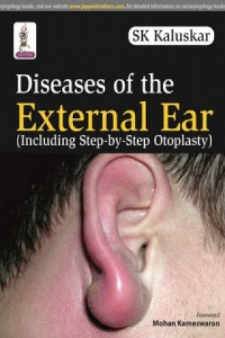 Könyv Diseases of the External Ear SK Kaluskar