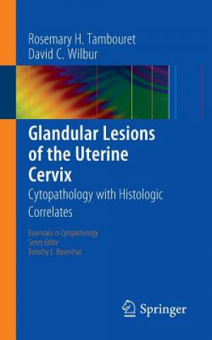 Carte Glandular Lesions of the Uterine Cervix Rosemary H. Tambouret