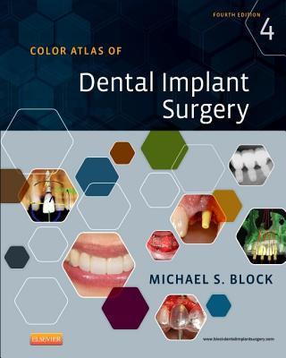 Könyv Color Atlas of Dental Implant Surgery Michael S. Block