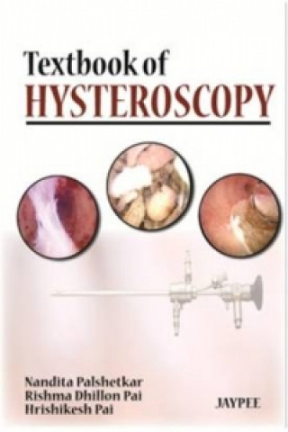 Book Textbook of Hysteroscopy Rishma Dhillon Pai