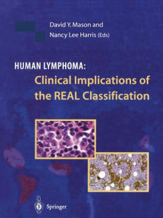 Könyv Human Lymphoma: Clinical Implications of the REAL Classification David Y. Mason