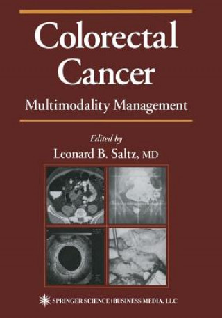Könyv Colorectal Cancer Leonard B. Saltz