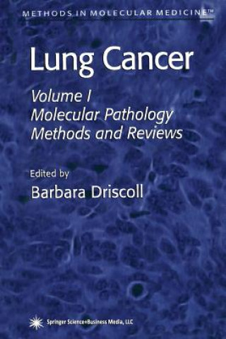 Kniha Lung Cancer Barbara Driscoll