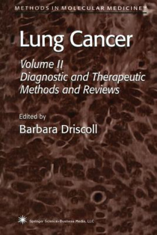 Kniha Lung Cancer Barbara Driscoll