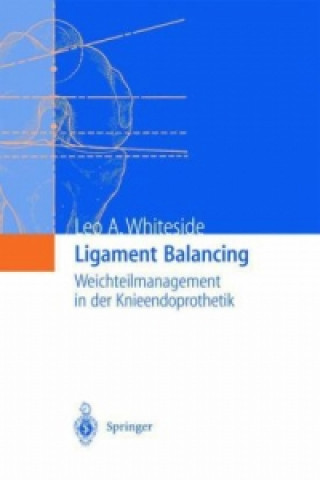 Kniha Ligament Balancing, 1 Leo A. Whiteside