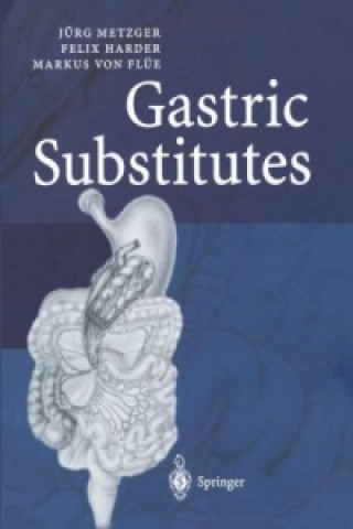 Boek Gastric Substitutes Jürg Metzger