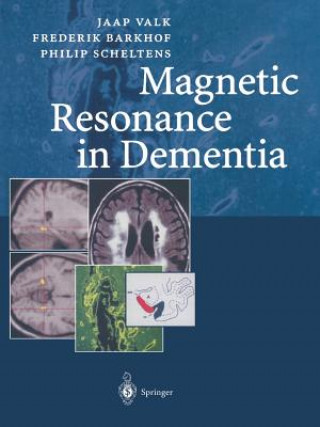 Kniha Magnetic Resonance in Dementia, 1 Frederik Barkhof