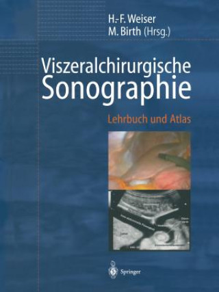 Könyv Viszeralchirurgische Sonographie H.-F. Weiser