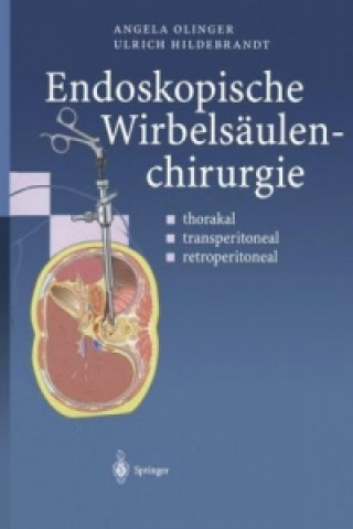 Kniha Endoskopische Wirbelsaulenchirurgie Angela Olinger