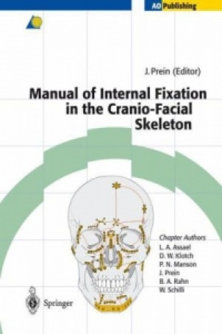 Książka Manual of Internal Fixation in the Cranio-Facial Skeleton Joachim Prein