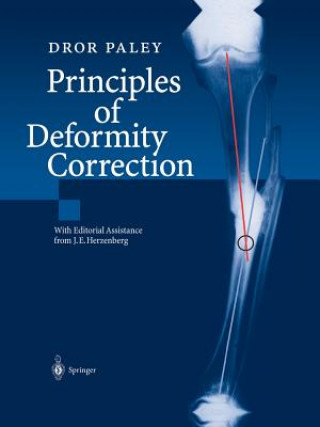 Carte Principles of Deformity Correction Dror Paley