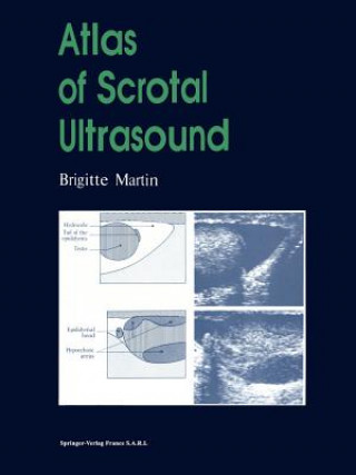 Könyv Atlas of Scrotal Ultrasound, 1 Brigitte Martin