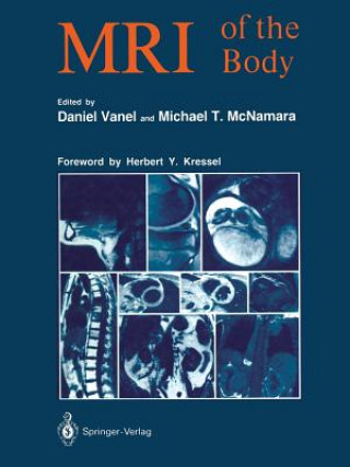 Kniha MRI of the Body Daniel Vanel