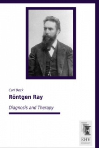 Carte Röntgen Ray Carl Beck