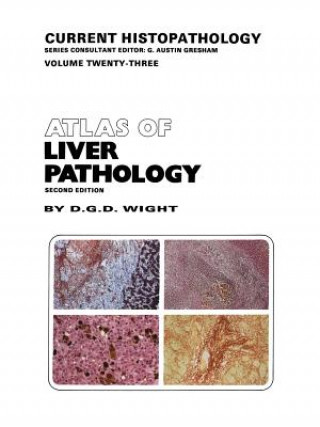 Könyv Atlas of Liver Pathology D.G. Wight