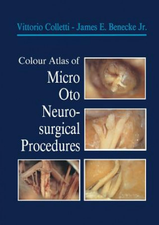 Kniha Colour Atlas of Micro-Oto-Neurosurgical Procedures Vittorio Colletti