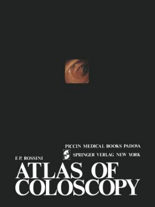 Kniha Atlas of coloscopy OSSINI