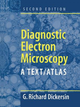 Kniha Diagnostic Electron Microscopy Richard G. Dickersin