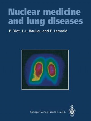 Kniha Nuclear medicine and lung diseases Patrice Diot