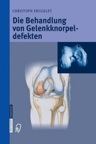 Carte Die Behandlung von Gelenkknorpeldefekten, 1 Christoph Erggelet