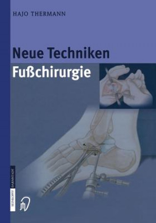 Kniha Neue Techniken Fusschirurgie, 1 Hajo Thermann