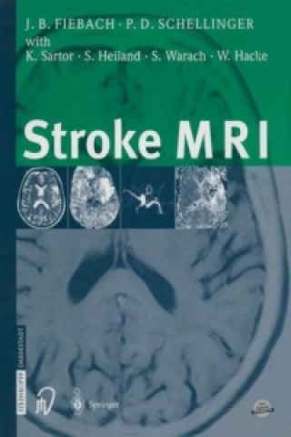 Книга Stroke MRI, 1 Jochen Fiebach