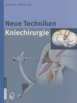 Książka Neue Techniken Kniechirurgie H.H. Pässler