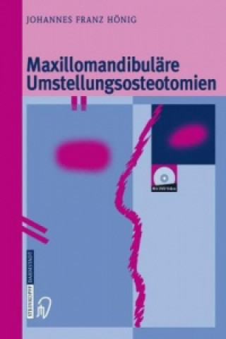 Knjiga Maxillomandibuläre Umstellungsosteotomien, 1 Johannes-Franz Hönig