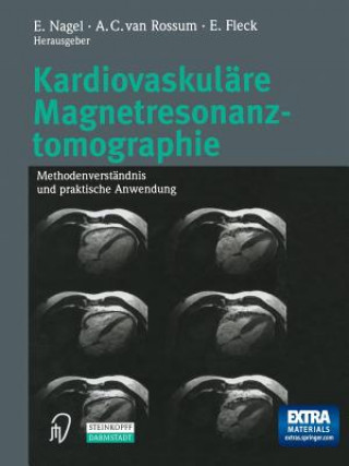 Könyv Kardiovaskuläre Magnetresonanztomographie, 1 E. Nagel