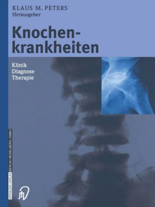 Könyv Knochenkrankheiten Klaus M. Peters