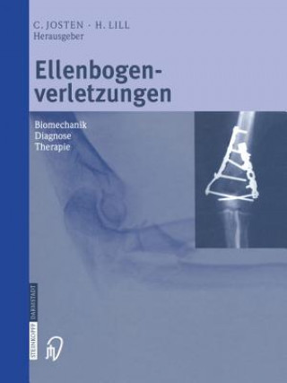 Könyv Ellenbogenverletzungen C. Josten