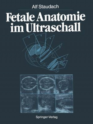 Carte Fetale Anatomie Im Ultraschall Alf Staudach