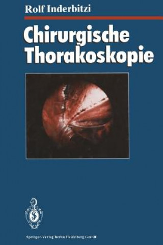 Knjiga Chirurgische Thorakoskopie Rolf Gilbert Carl Inderbitzi
