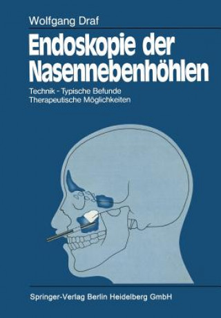 Knjiga Endoskopie Der Nasennebenhoehlen Wolfgang Draf