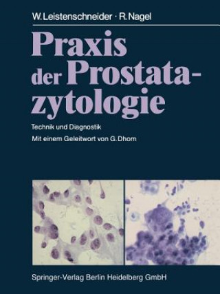 Könyv Praxis Der Prostatazytologie W. Leistenschneider