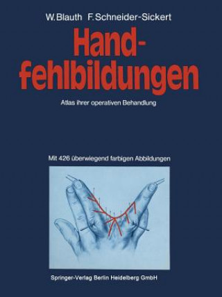 Kniha Handfehlbildungen, 1 W. Blauth