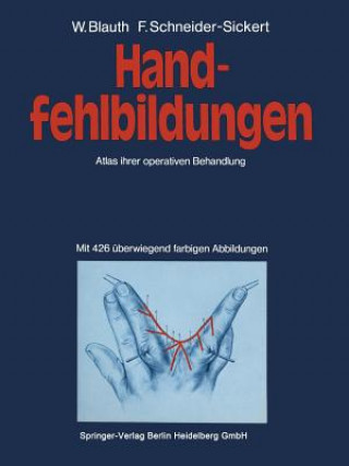 Buch Handfehlbildungen, 1 W. Blauth