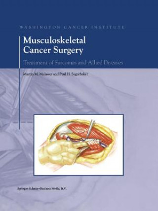 Книга Musculoskeletal Cancer Surgery, 1 Martin M. Malawer