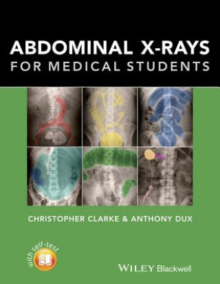 Könyv Abdominal X-rays for Medical Students Christopher Clarke