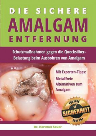 Kniha sichere Amalgam-Entfernung Hartmut Sauer