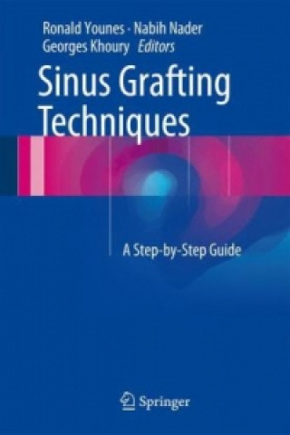 Kniha Sinus Grafting Techniques, w. DVD-ROM Ronald Younes